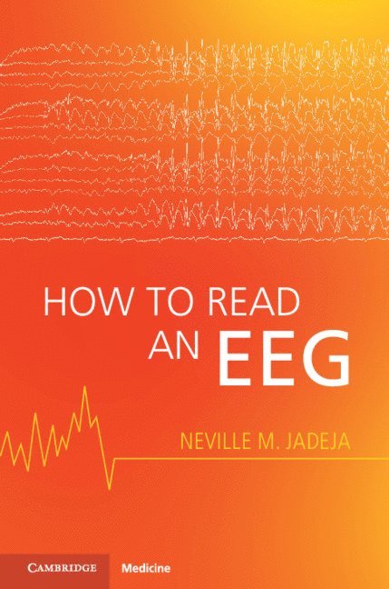 How to Read an EEG 1