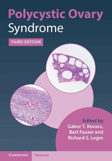 Gabor T. Kovacs, Bart Fauser, Richard S. Legro - Polycystic Ovary Syndrome, Inbunden