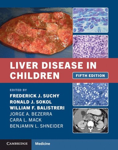 bokomslag Liver Disease in Children