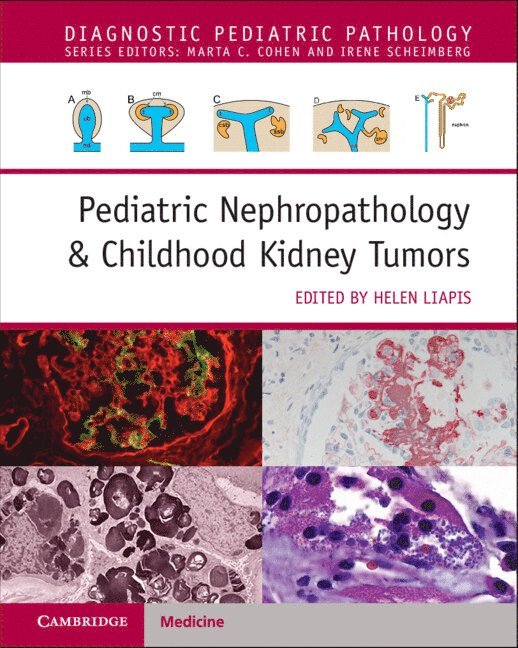 Pediatric Nephropathology & Childhood Kidney Tumors with Online Resource 1