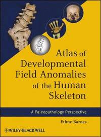 bokomslag Atlas of Developmental Field Anomalies of the Human Skeleton