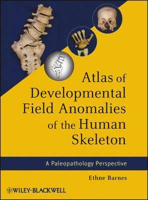 Atlas of Developmental Field Anomalies of the Human Skeleton 1