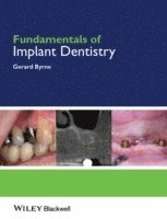 bokomslag Fundamentals of Implant Dentistry