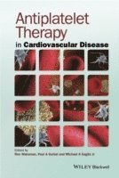 bokomslag Antiplatelet Therapy in Cardiovascular Disease