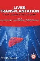 bokomslag Liver Transplantation