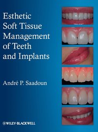 bokomslag Esthetic Soft Tissue Management of Teeth and Implants