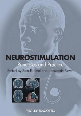 bokomslag Neurostimulation