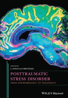 bokomslag Posttraumatic Stress Disorder