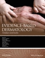 bokomslag Evidence-Based Dermatology