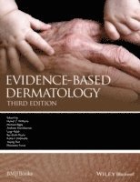 Michael Bigby, Andrew Herxheimer, Luigi Naldi, Berthold Rzany, Robert Dellavalle, Yuping Ran, Masutaka Furue - Evidence-Based Dermatology, Inbunden