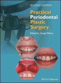 bokomslag Practical Periodontal Plastic Surgery