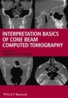 bokomslag Interpretation Basics of Cone Beam Computed Tomography