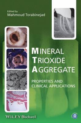 Mineral Trioxide Aggregate 1