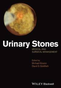 bokomslag Urinary Stones