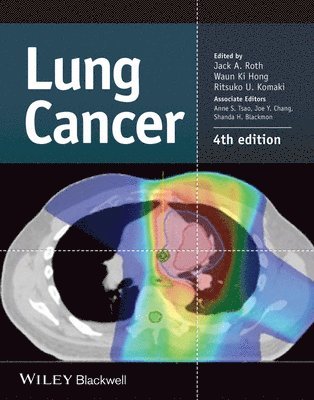 Jack A. Roth, Waun Ki Hong, Ritsuko U. Komaki - Lung Cancer, Inbunden