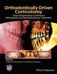 bokomslag Orthodontically Driven Corticotomy