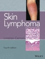 bokomslag Skin Lymphoma