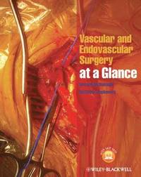 bokomslag Vascular and Endovascular Surgery at a Glance