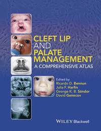 bokomslag Cleft Lip and Palate Management