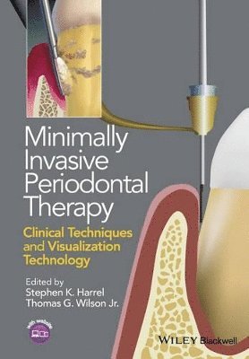 bokomslag Minimally Invasive Periodontal Therapy