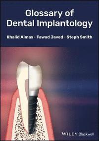 bokomslag Glossary of Dental Implantology