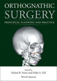 bokomslag Orthognathic Surgery