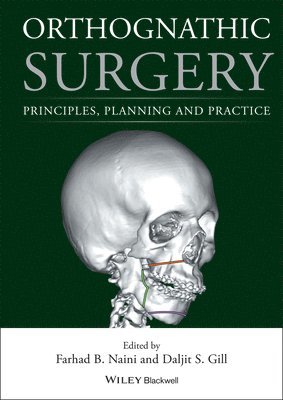 Farhad B. Naini, Daljit S. Gill - Orthognathic Surgery, Inbunden