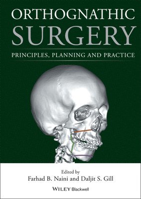 Orthognathic Surgery 1