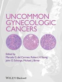 bokomslag Uncommon Gynecologic Cancers