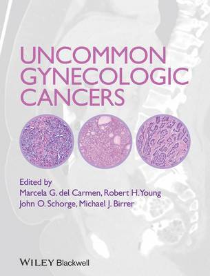 Uncommon Gynecologic Cancers 1