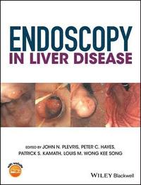 bokomslag Endoscopy in Liver Disease