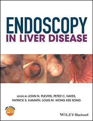 John N. Plevris, Peter C. Hayes, Patrick S. Kamath, Louis-Michel Wong Kee Song - Endoscopy in Liver Disease, Inbunden