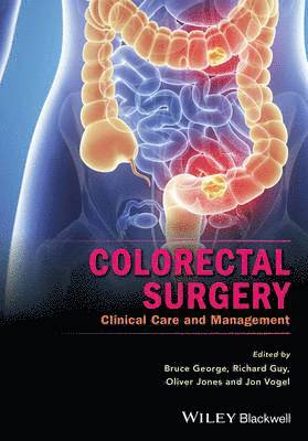 Bruce George, Richard Guy, Oliver Jones, Jon Vogel - Colorectal Surgery, Inbunden
