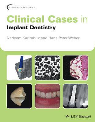 bokomslag Clinical Cases in Implant Dentistry