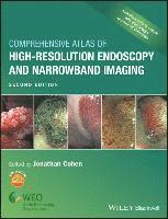 bokomslag Comprehensive Atlas of High-Resolution Endoscopy and Narrowband Imaging