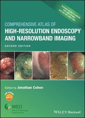 Jonathan Cohen - Comprehensive Atlas of High-Resolution Endoscopy and Narrowband Imaging, Inbunden