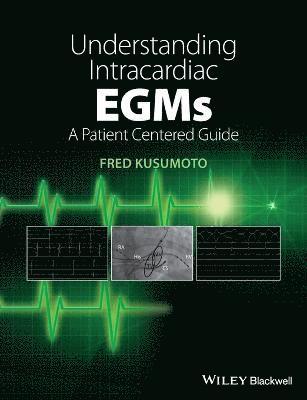 Understanding Intracardiac EGMs 1