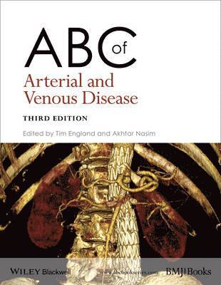 ABC of Arterial and Venous Disease 1