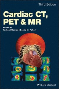 bokomslag Cardiac CT, PET and MR