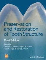 bokomslag Preservation and Restoration of Tooth Structure