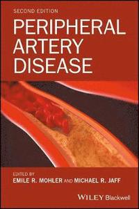 bokomslag Peripheral Artery Disease