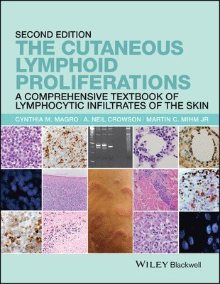 bokomslag The Cutaneous Lymphoid Proliferations