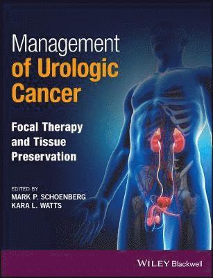 bokomslag Management of Urologic Cancer
