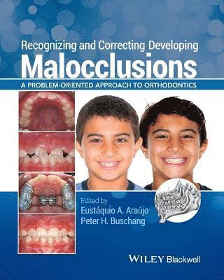 Eustáquio A. Araújo, Peter H. Buschang - Recognizing and Correcting Developing Malocclusions, Häftad