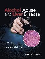 bokomslag Alcohol Abuse and Liver Disease