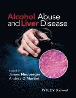 bokomslag Alcohol Abuse and Liver Disease