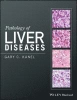 bokomslag Pathology of Liver Diseases