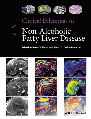 bokomslag Clinical Dilemmas in Non-Alcoholic Fatty Liver Disease