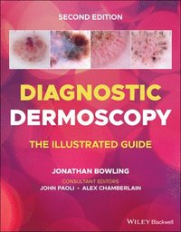 bokomslag Diagnostic Dermoscopy