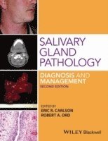 bokomslag Salivary Gland Pathology: Diagnosis and Management